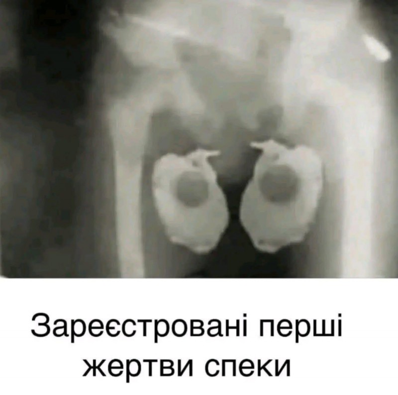 Сурет